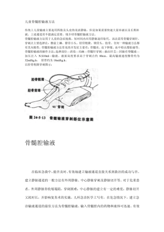 儿童骨髓腔输液方法