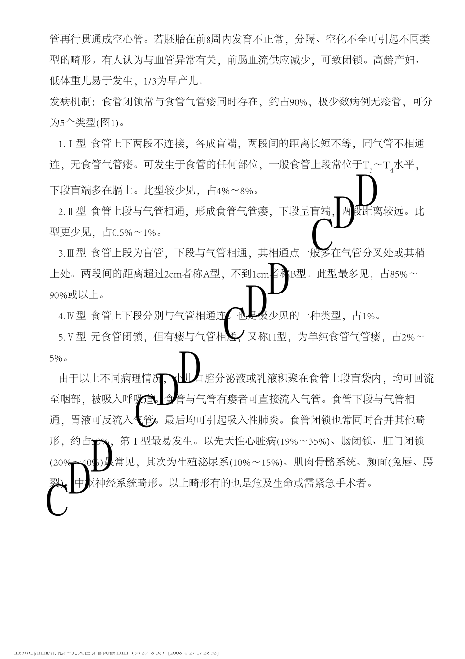 先天性食管闭锁_第2页