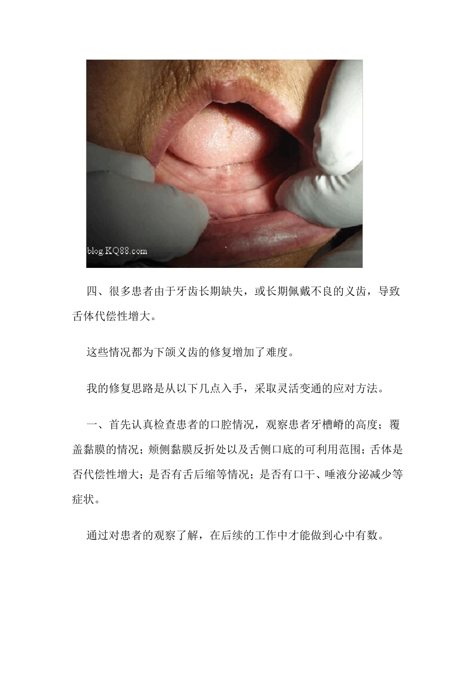 全口义齿修复经验_第2页