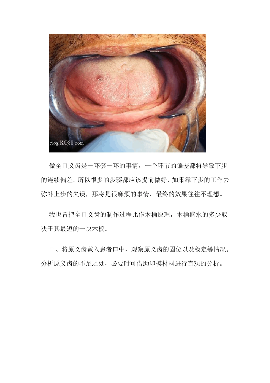 全口义齿修复经验_第3页