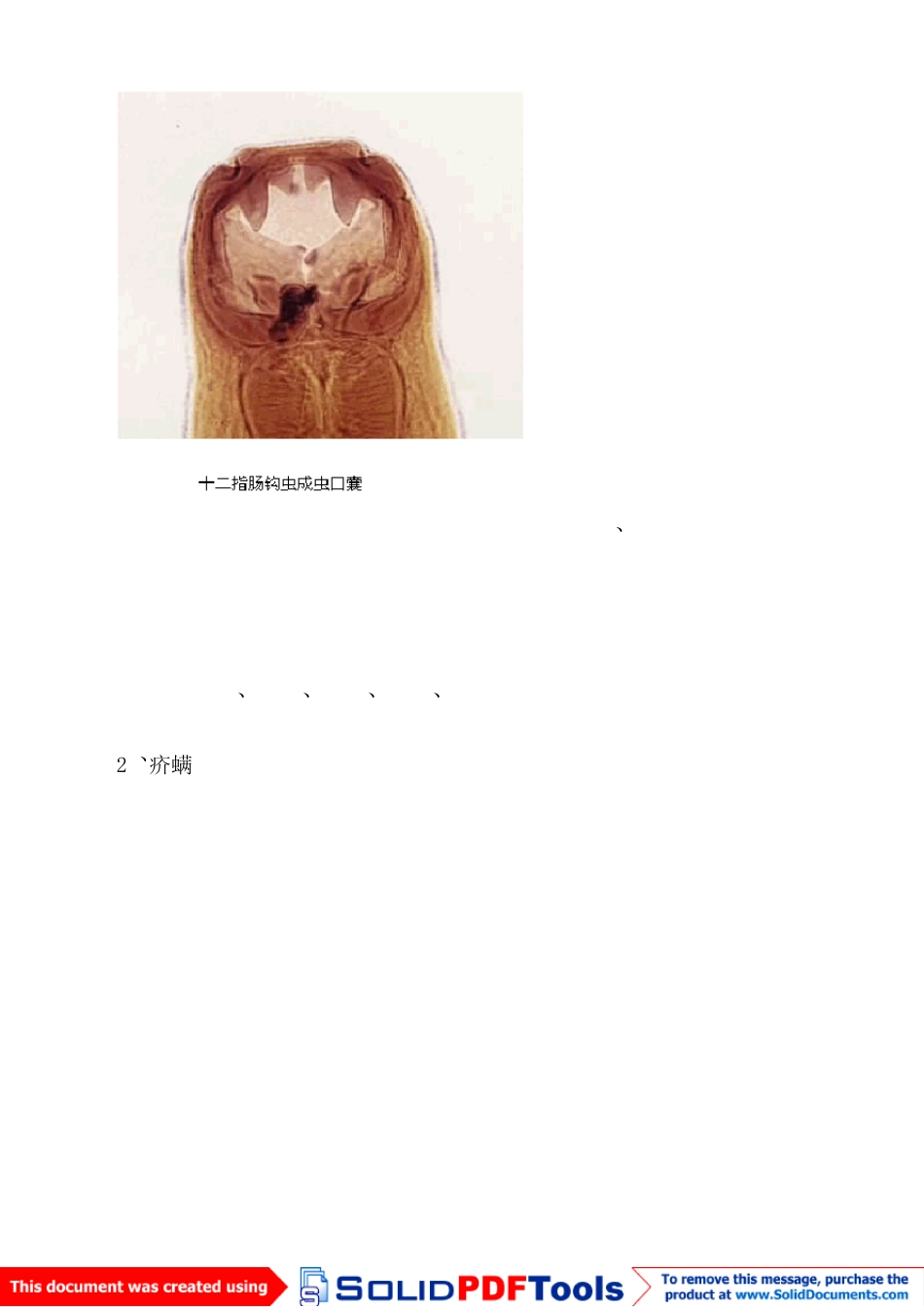 十种最常见的人体寄生虫_第3页