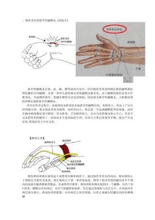 桡骨茎突部狭窄性腱鞘炎(妈妈手)