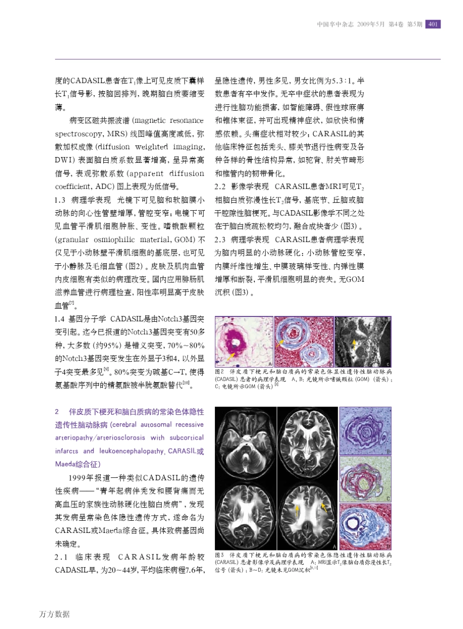 单基因遗传性脑小血管病_第2页