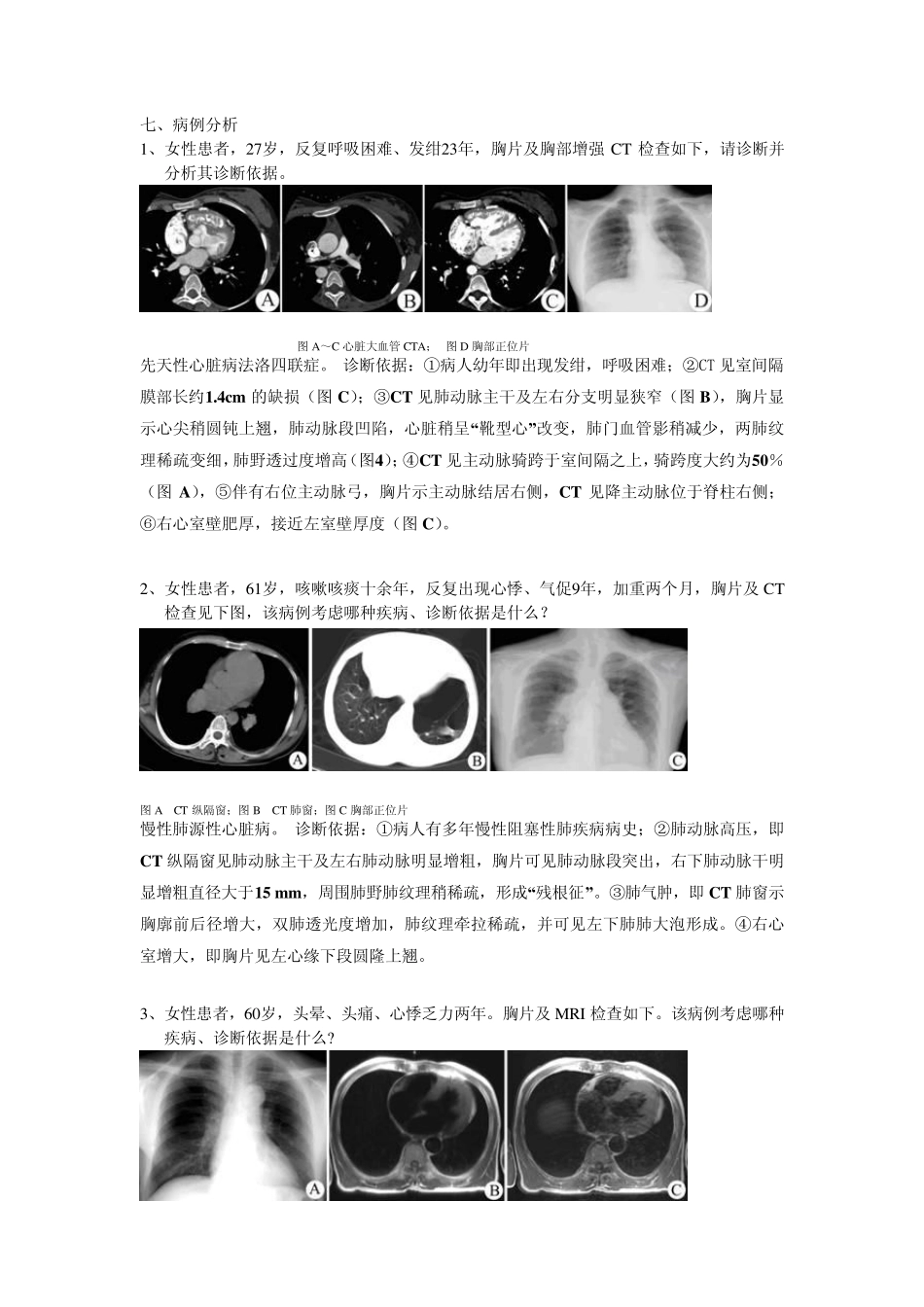 南方医科大学影像学课程试题(循环系统)_第3页