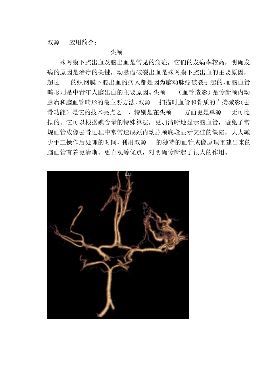 双源CT应用简介_第1页