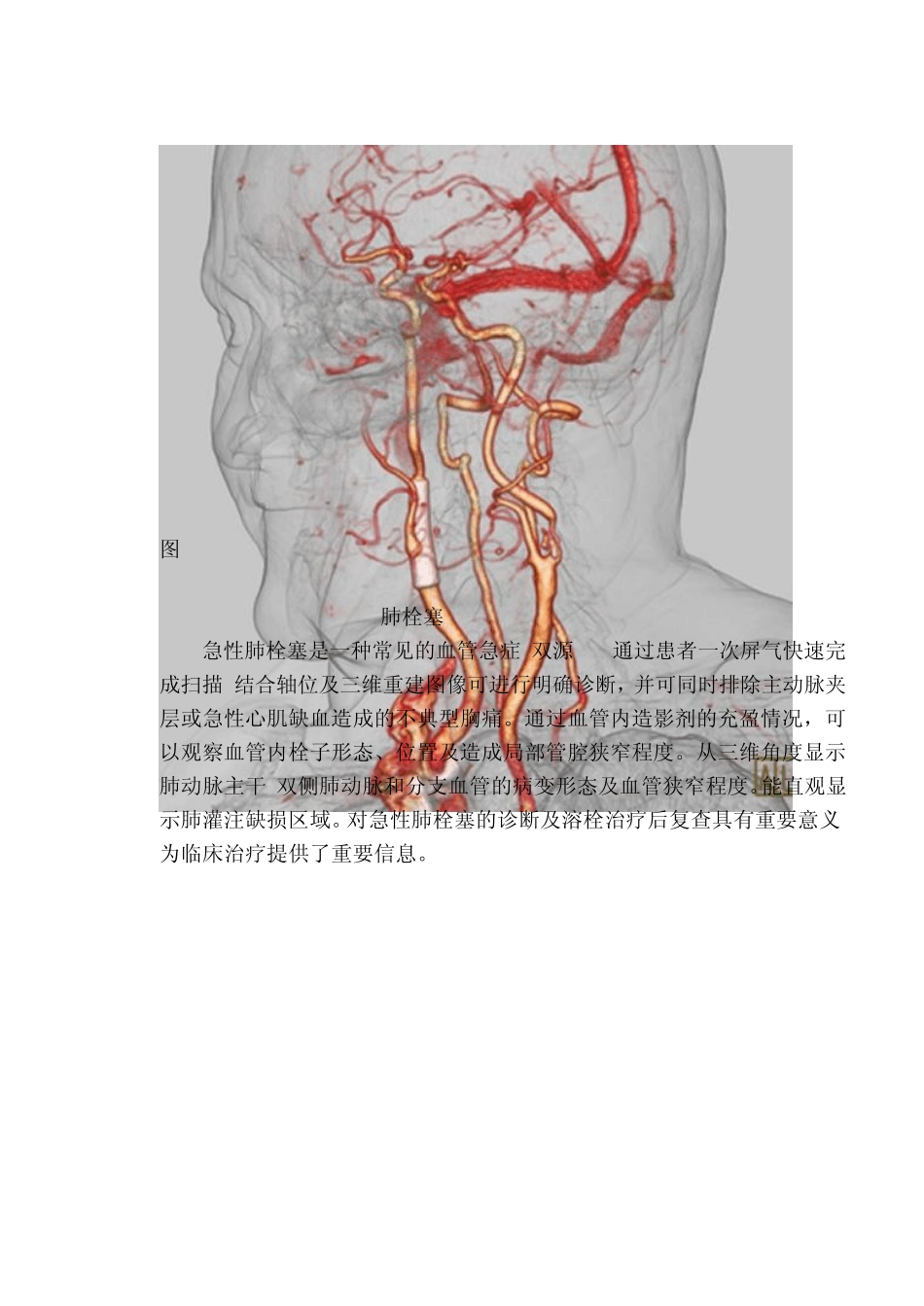 双源CT应用简介_第2页
