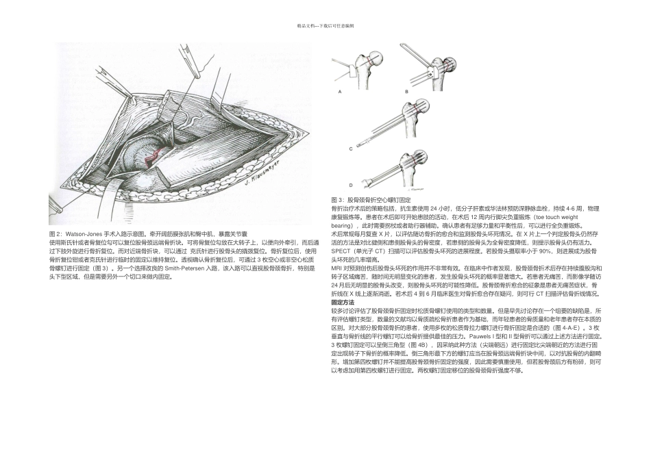 JBJS年轻患者股骨颈骨折的治疗_第2页