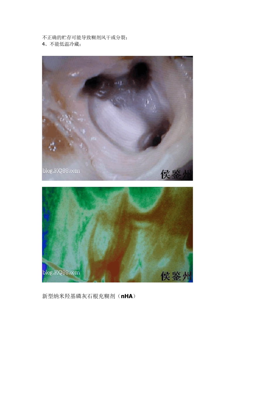 口腔常用材料_第2页