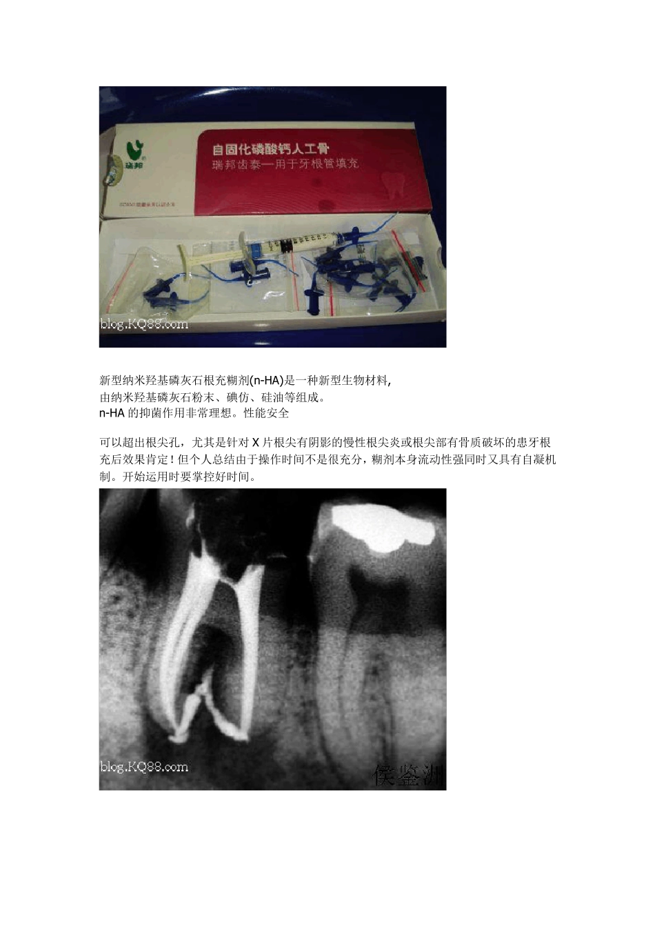 口腔常用材料_第3页