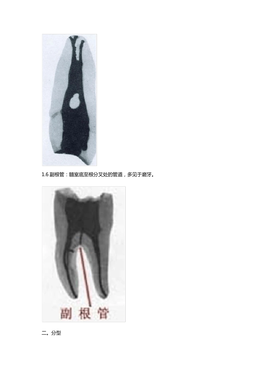 口腔根管系统_第3页