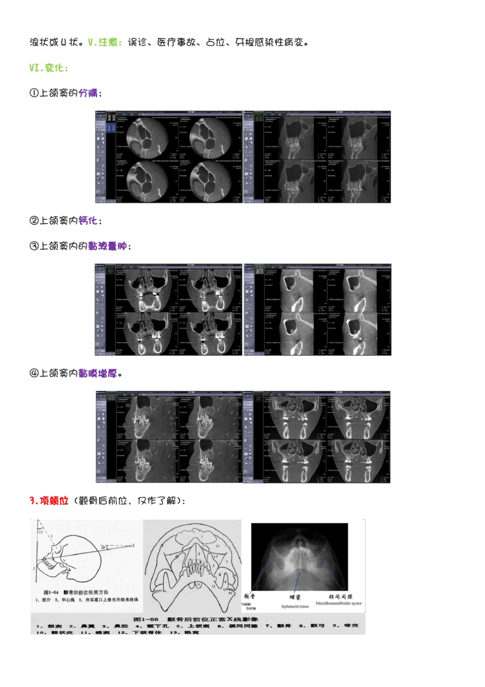 口腔颌面影像诊断_第3页