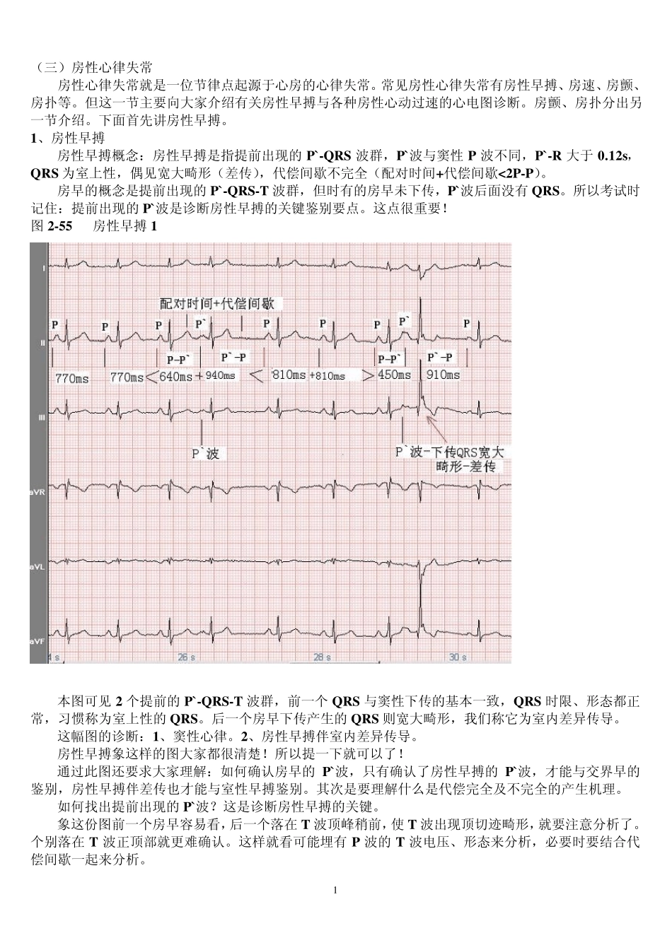 另类心电图讲义3房性心律失常_第1页
