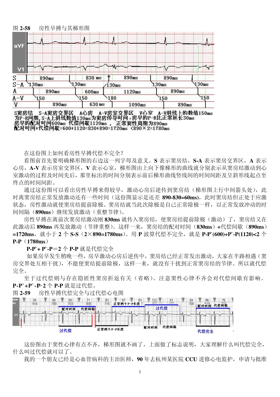 另类心电图讲义3房性心律失常_第3页