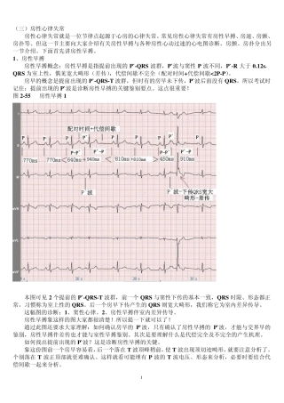 另类心电图讲义3房性心律失常