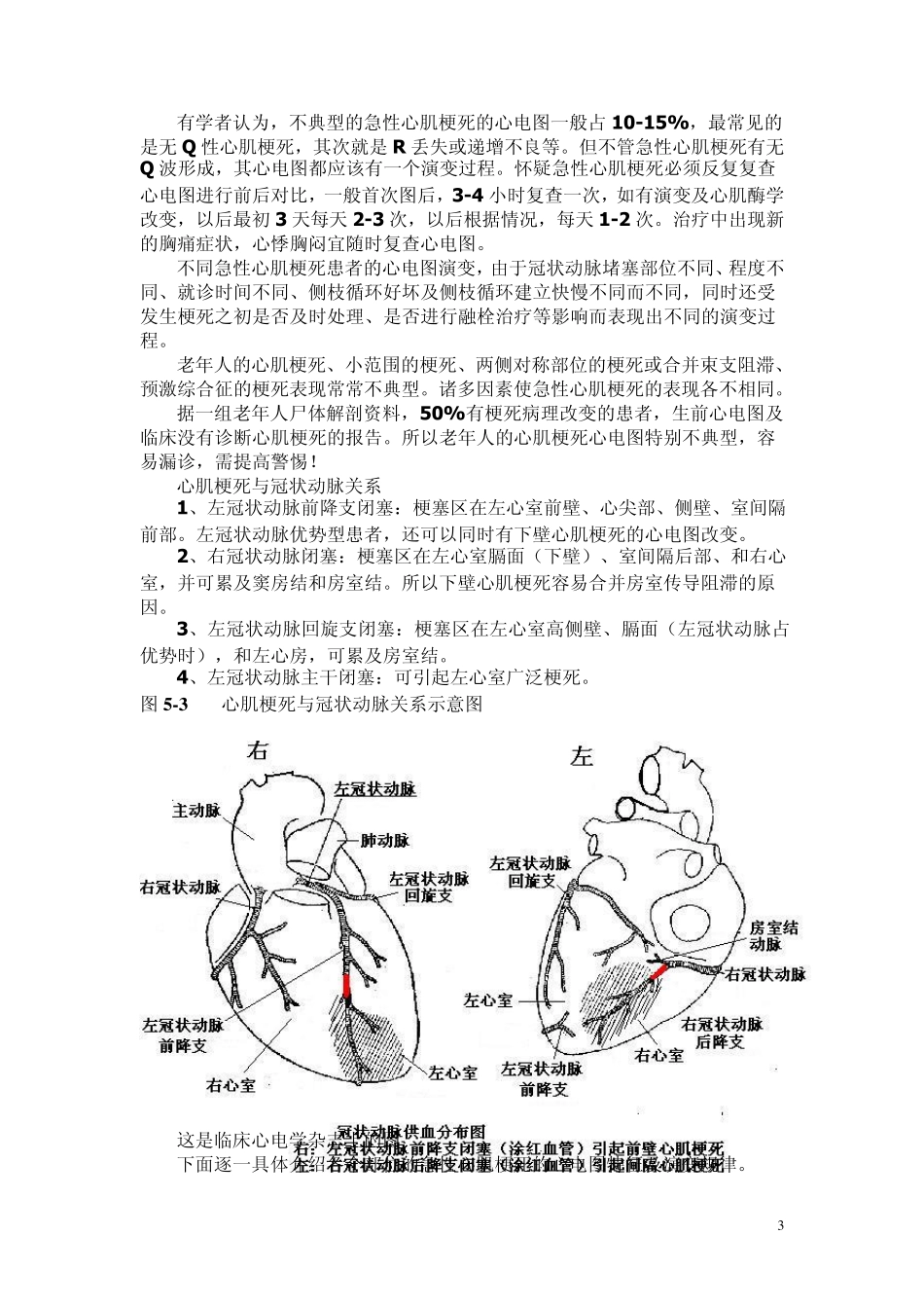 另类心电图讲义13心肌梗死心电图诊断_第3页