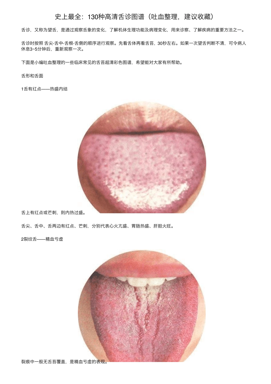 史上最全：130种高清舌诊图谱(吐血整理,建议收藏)_第1页