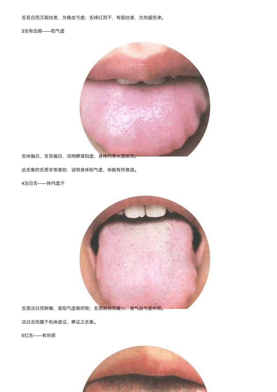史上最全：130种高清舌诊图谱(吐血整理,建议收藏)_第2页