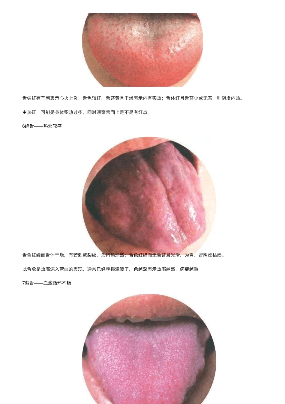 史上最全：130种高清舌诊图谱(吐血整理,建议收藏)_第3页