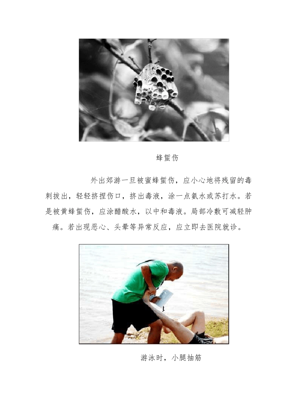 各种意外伤害的急救方法_第2页