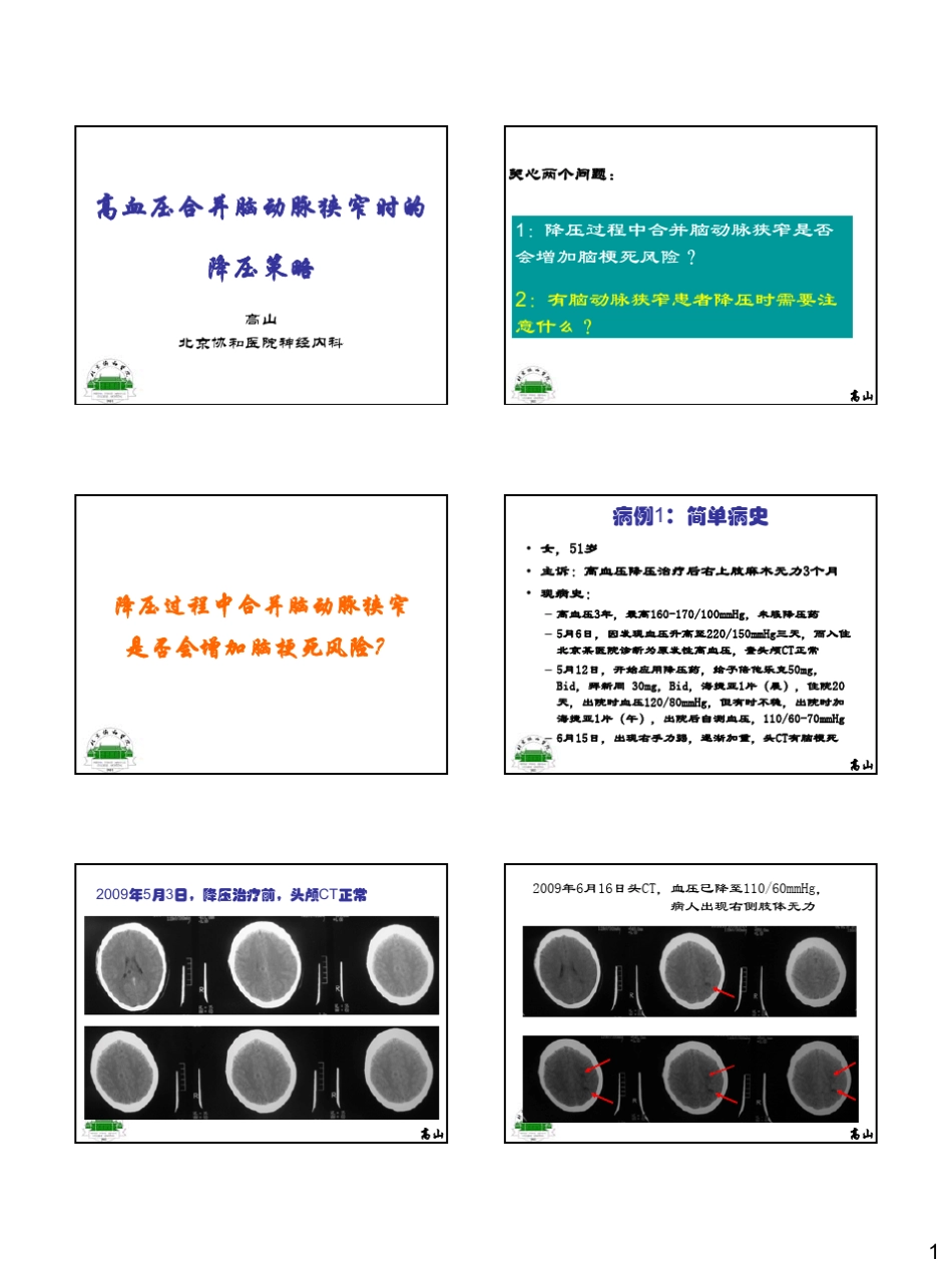 合并脑动脉狭窄的降压策略_第1页