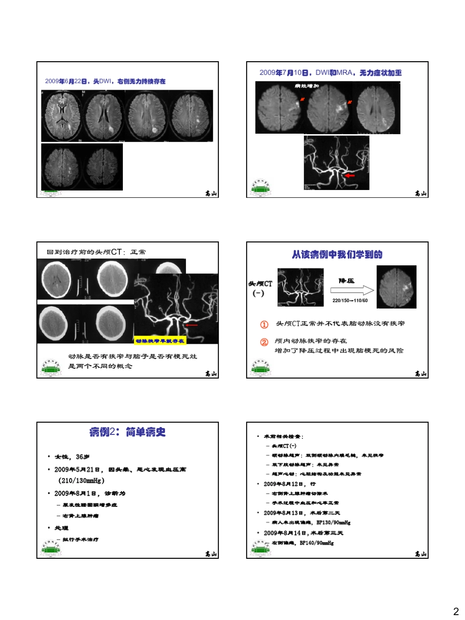 合并脑动脉狭窄的降压策略_第2页