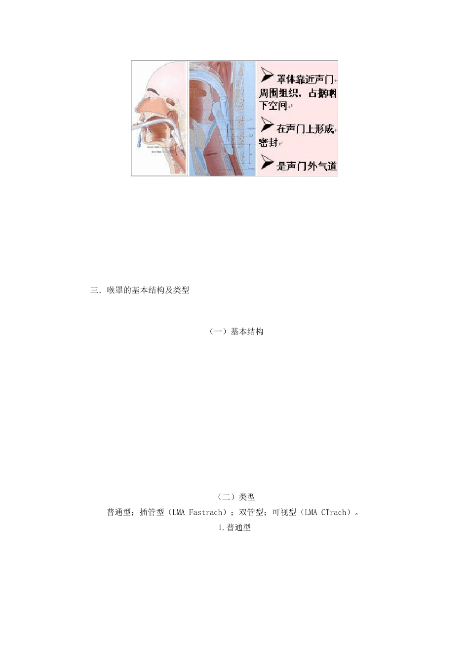 喉罩及其临床应用_第2页
