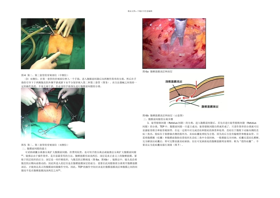 TEP的手术步骤和规范要_第2页