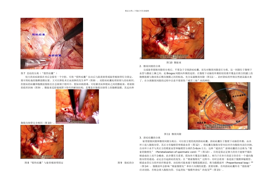 TEP的手术步骤和规范要_第3页
