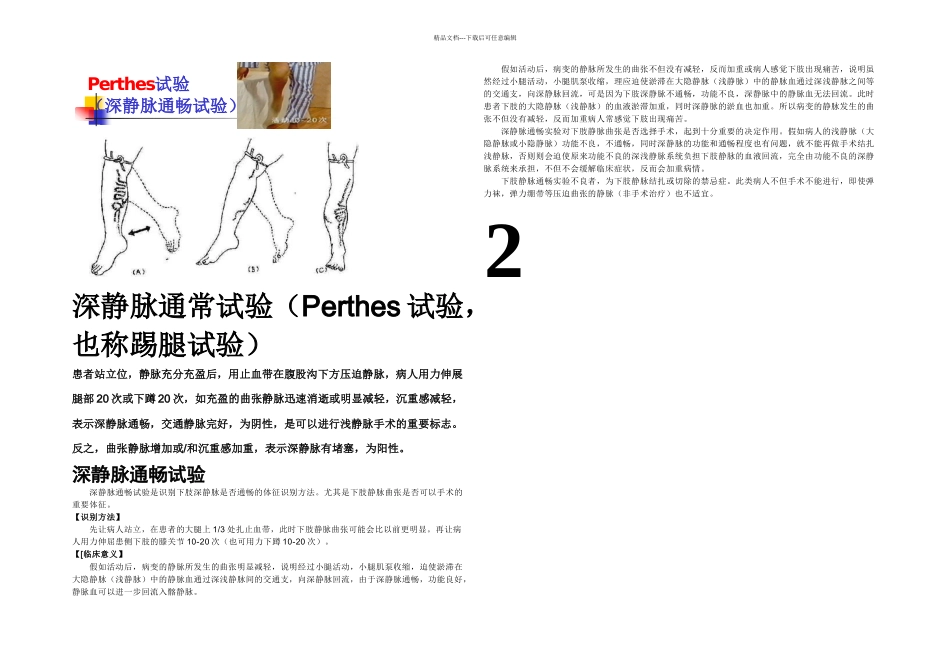 下肢静脉曲张三种检查方法_第1页