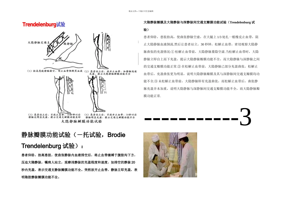 下肢静脉曲张三种检查方法_第2页