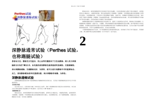 下肢静脉曲张三种检查方法