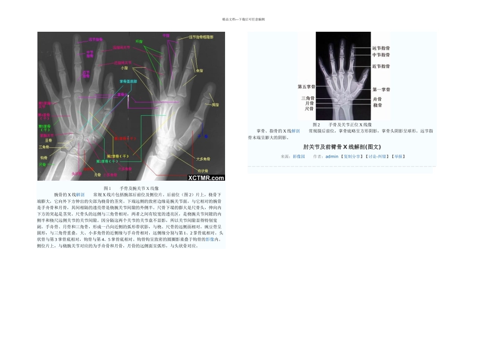 下肢骨X线解剖讲解非常_第2页