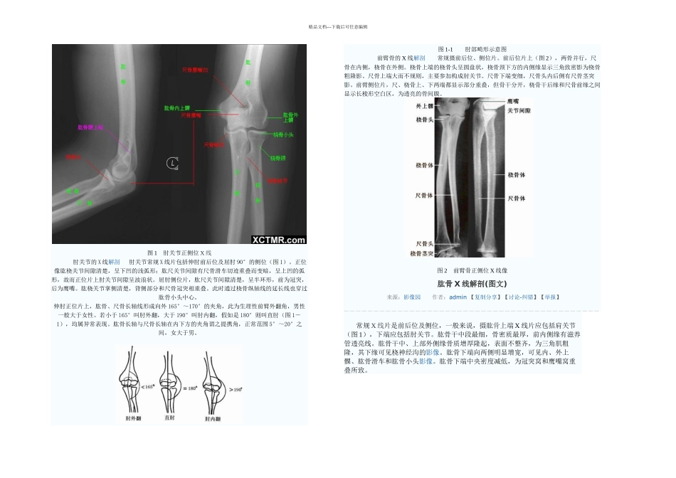 下肢骨X线解剖讲解非常_第3页