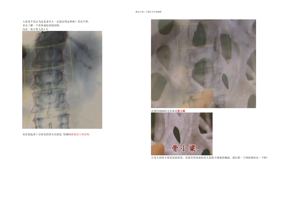 中医治疗骨质疏松_第1页