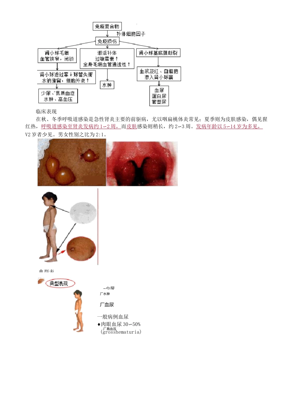 儿科护理学- 泌尿系统疾病患儿的护理_第3页