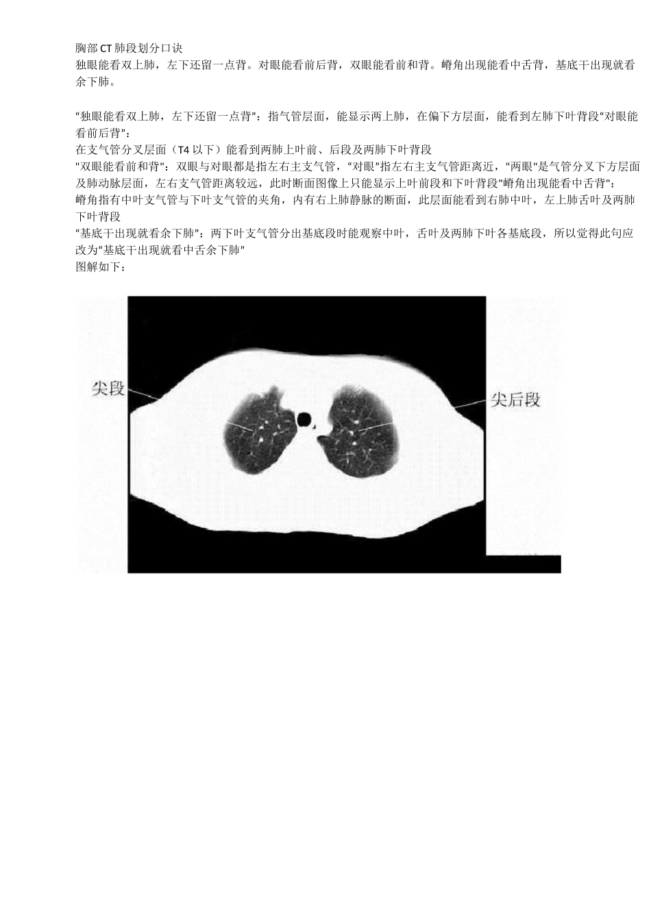 胸部CT肺段划分口诀_第1页
