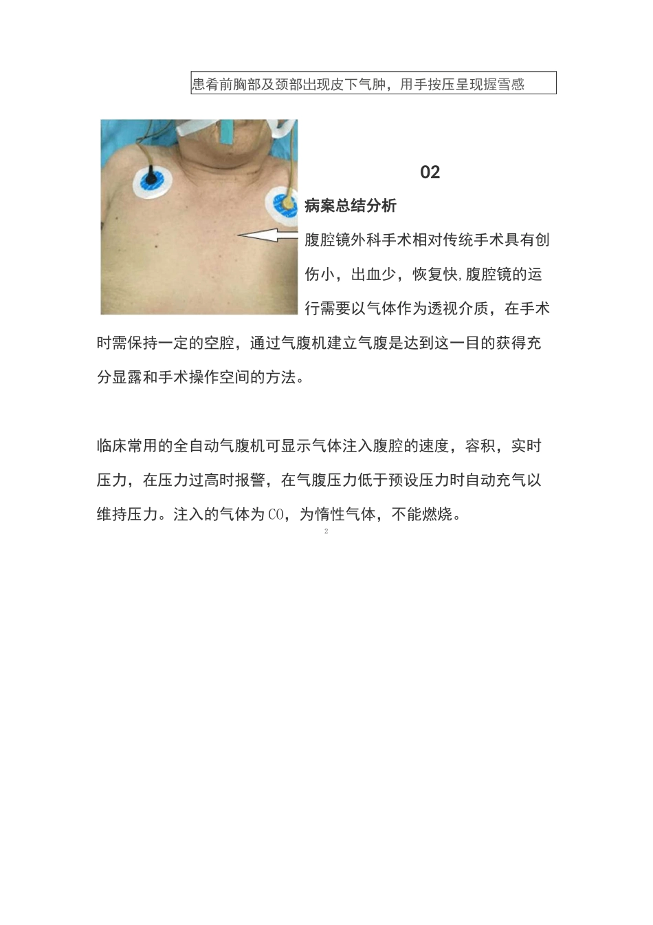 术中出现了皮下气肿该如何处理？_第2页