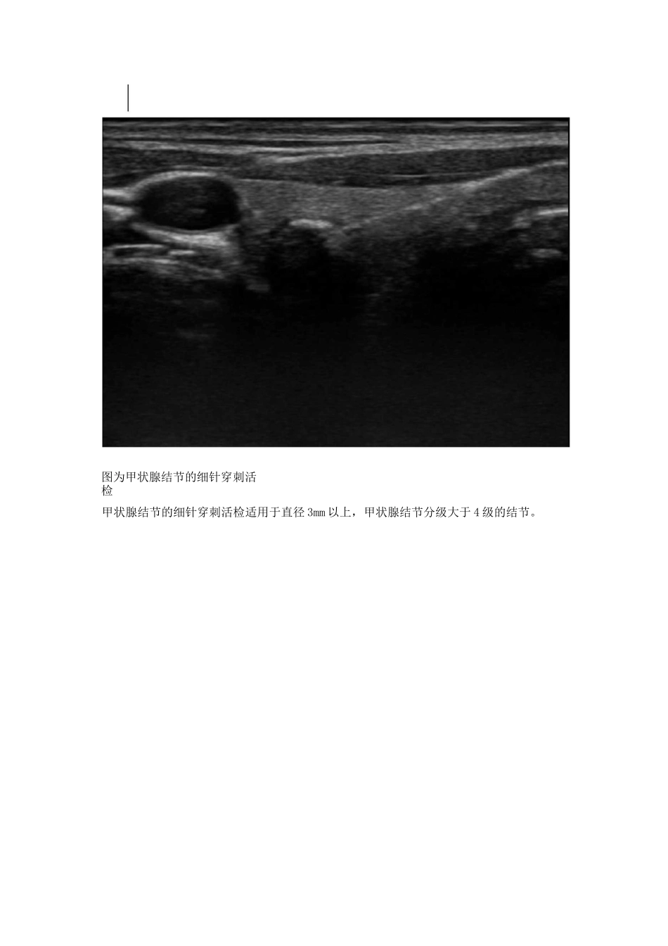 超声介入科宣传_第2页