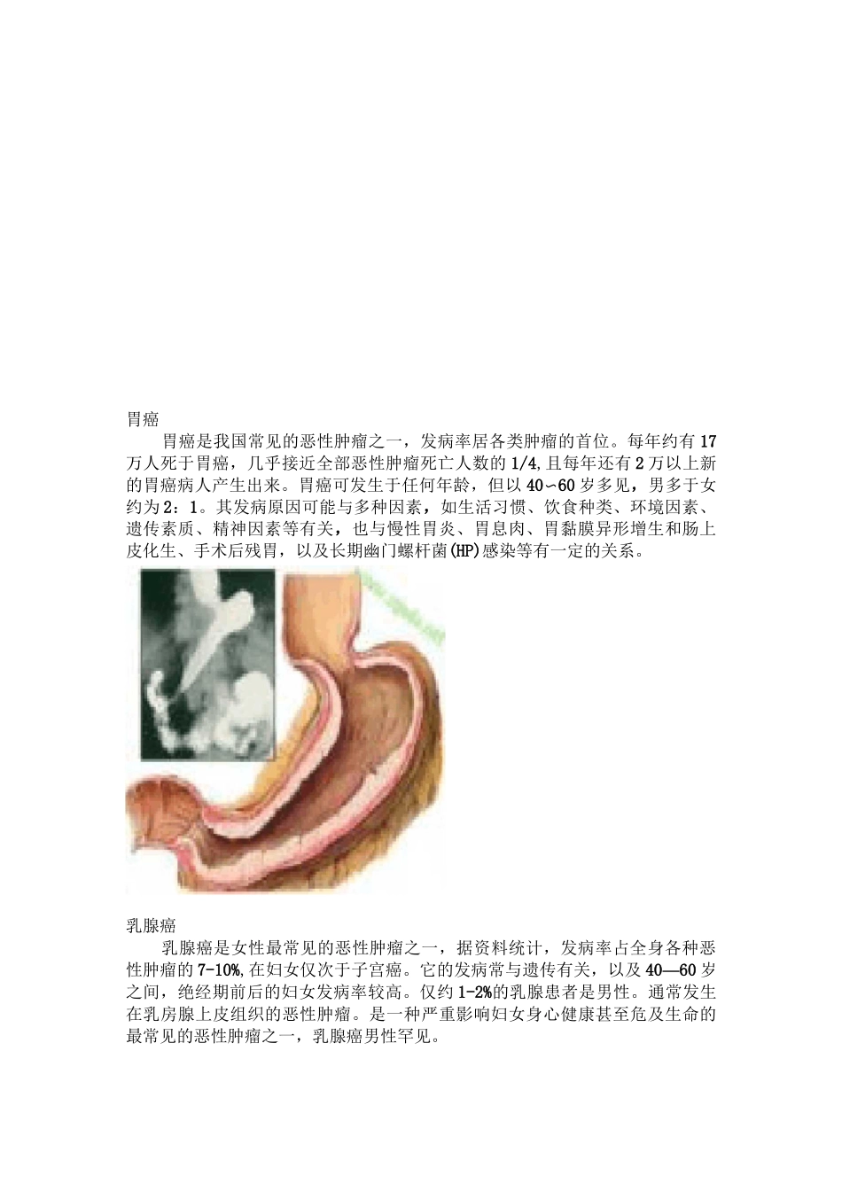 常见的10大恶性肿瘤是哪些_第2页