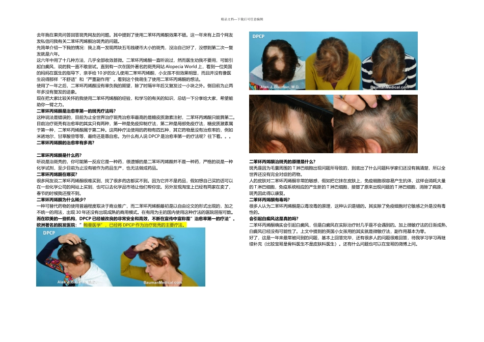 二苯环丙烯酮治疗斑秃问题总汇_第1页
