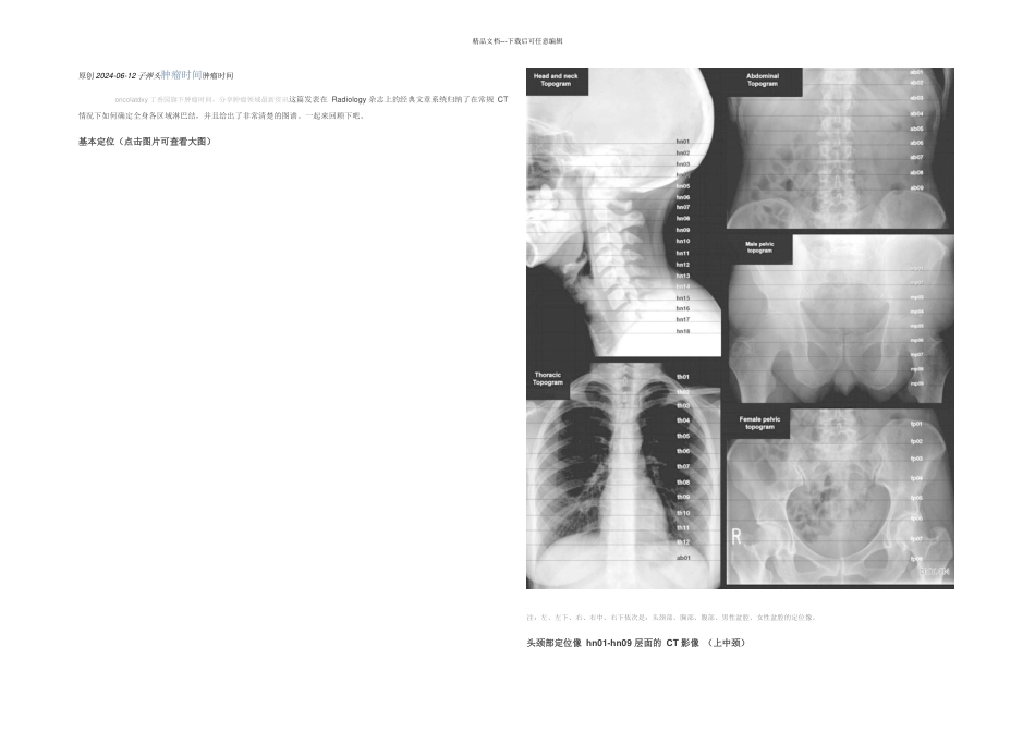 全身淋巴结分区CT图谱_第1页