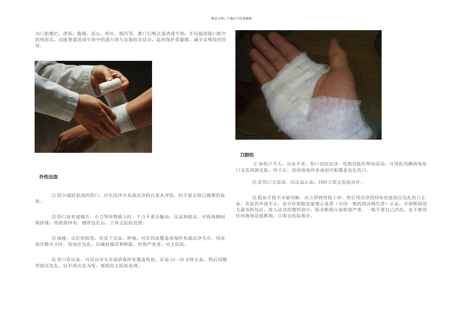 急救方法收藏_第2页