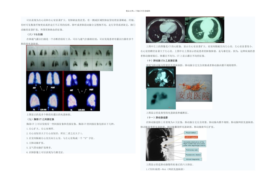 慢性血栓栓塞性肺动脉高压外科治疗_第2页