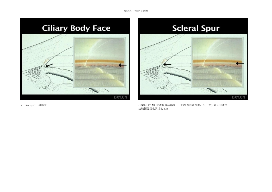 房角镜下的结构_第2页