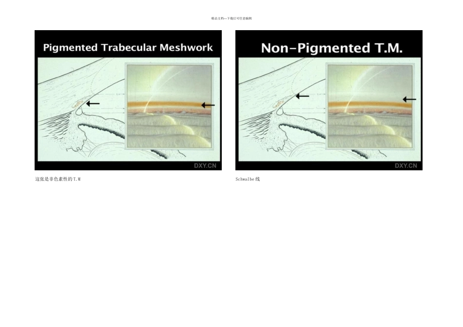 房角镜下的结构_第3页