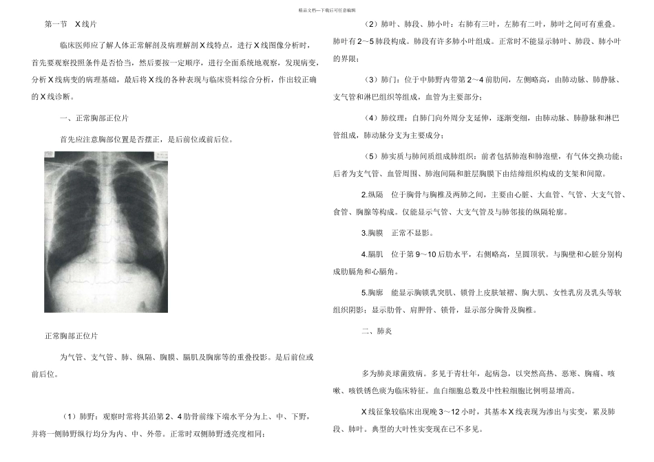 放射诊断学X线各个病变介绍_第1页