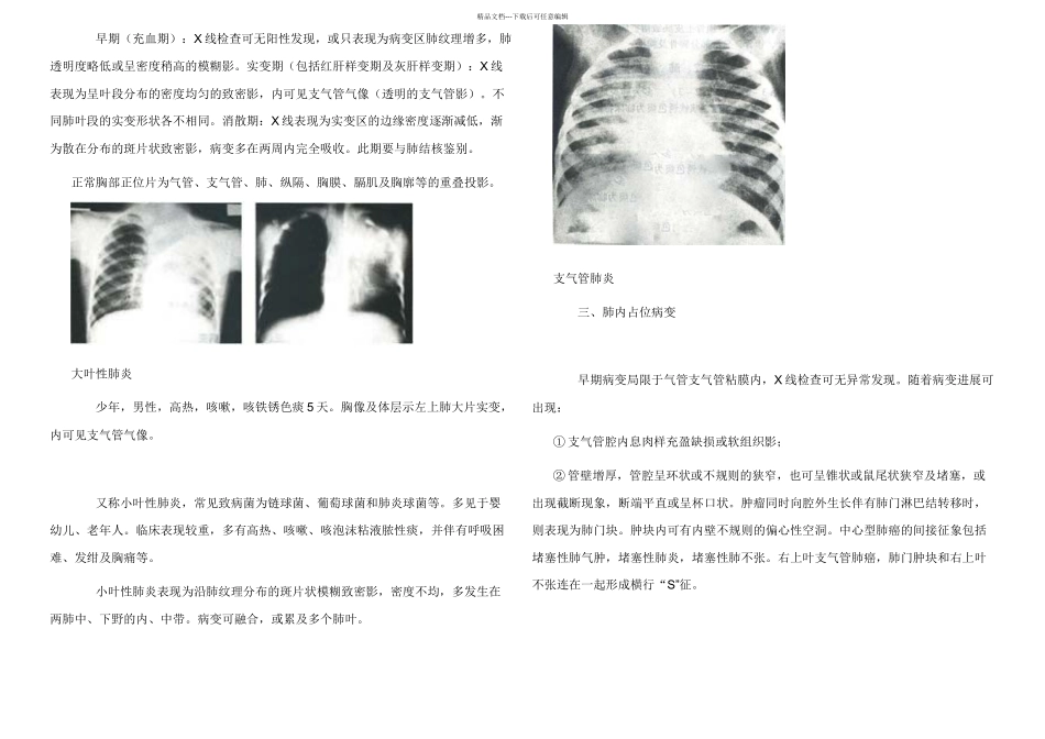 放射诊断学X线各个病变介绍_第2页