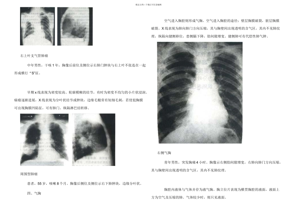 放射诊断学X线各个病变介绍_第3页
