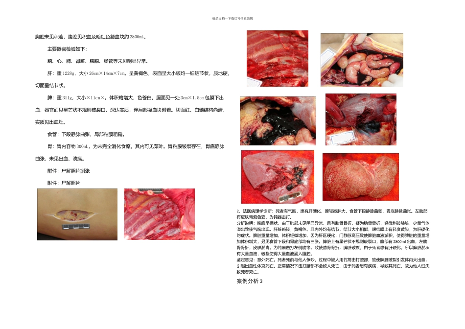 新医选修课法医考试试题及答案_第2页