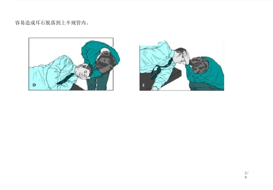 耳石症手法复位图示详解文选_第2页